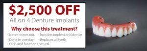 All on 4 Dental Implants Salt Lake City Utah