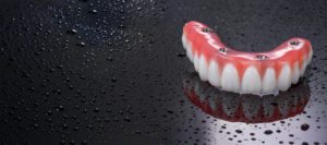 all on 4 dental implants slc utah