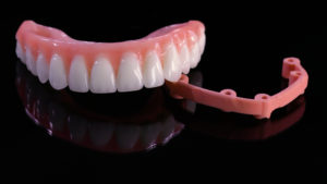 resin dental implant