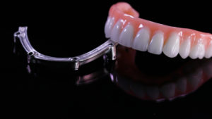 titanium dental implants