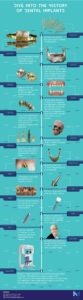 history of implants