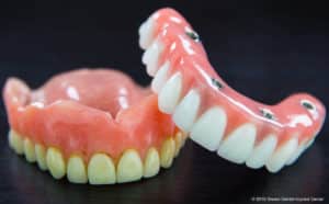 Don't settle for Dentures